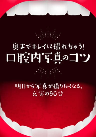 ランキング19位の奥までキレイに撮れちゃう口腔内写真。口腔内診査に活かす