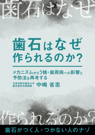 ランキング2位の歯石はなぜ、作られるのか？