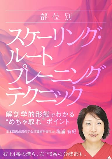 ランキング9位の部位別「スケーリング・ルートプレーニング」テクニック