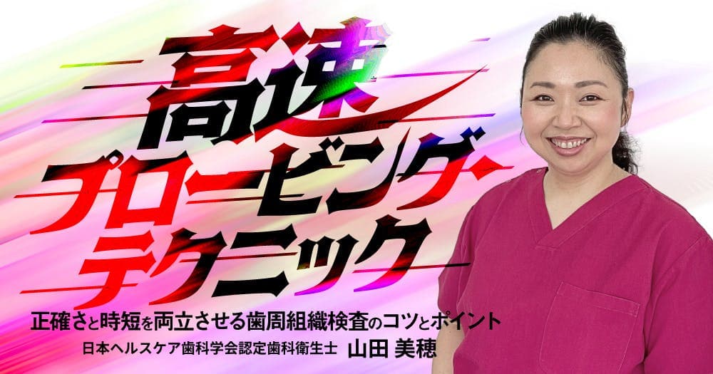 高速プロービング・テクニック