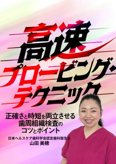 ランキング20位の高速プロービング・テクニック