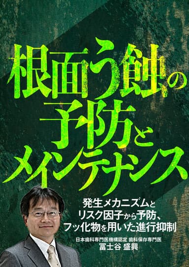ランキング13位の根面う蝕の予防とメインテナンス