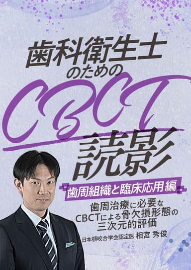 ランキング6位の歯科衛生士のためのCBCT読影「歯周組織と臨床応用」編