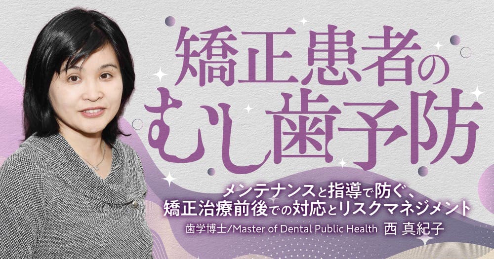 矯正患者のむし歯予防