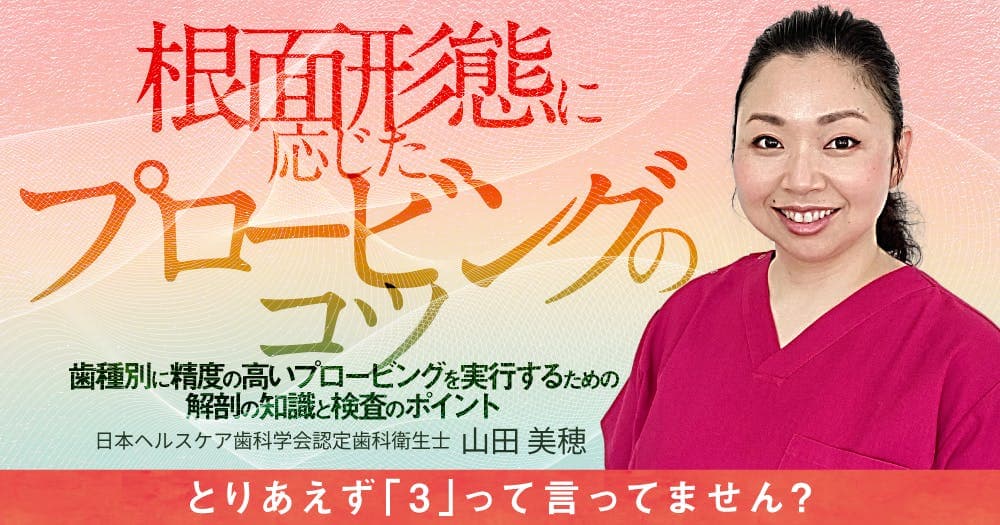 根面形態に応じたプロービングのコツ